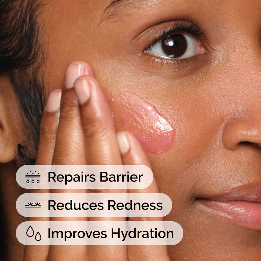 The Ordinary Soothing & Barrier Support Ser Um 30Ml